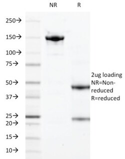 S100A9 Antibody (47-8D3 (DF3973)), Novus Biologicals:Antibodies:Primary